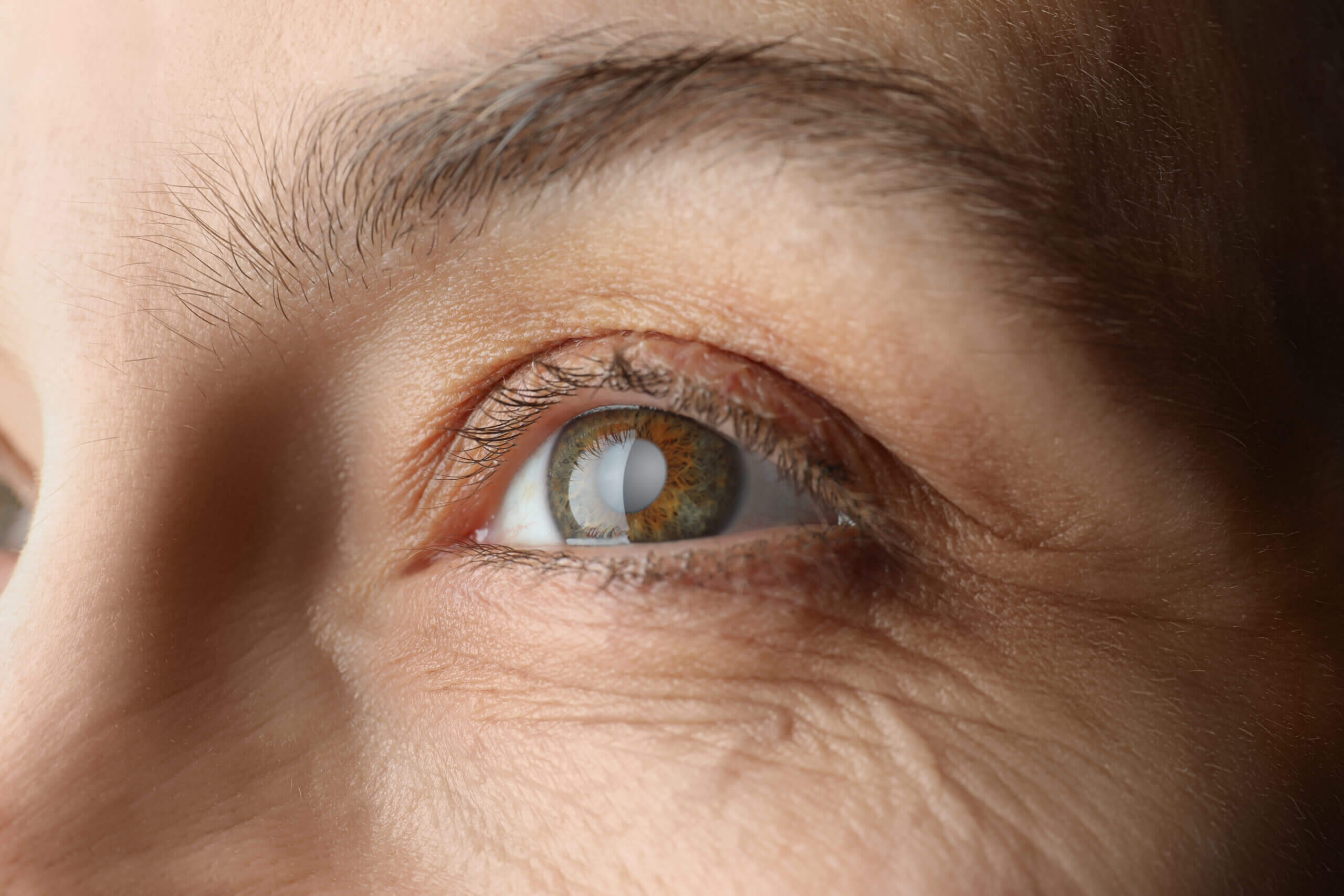 Understanding the Basics of Common Eye Conditions